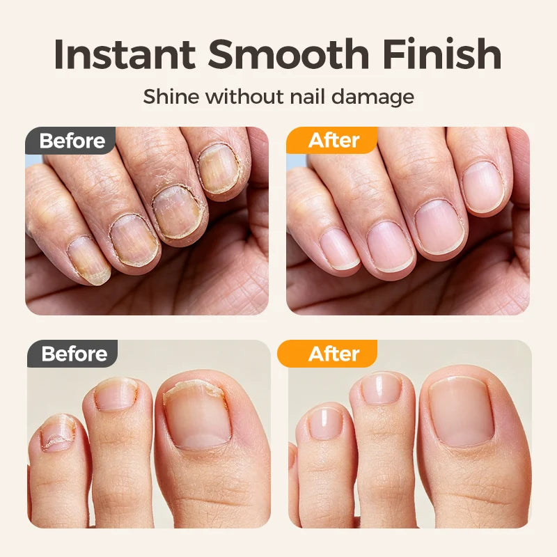 Electric Nail Clipper & Trimmer