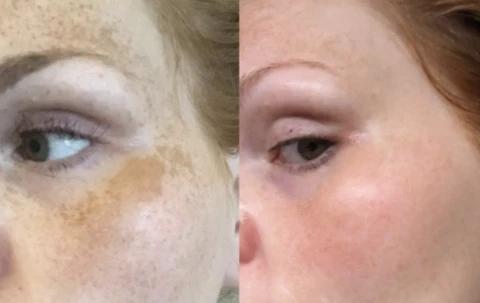 Mabox Vitamin C Serum; Mabox 2.5% Retinol Moisturizer Face Cream