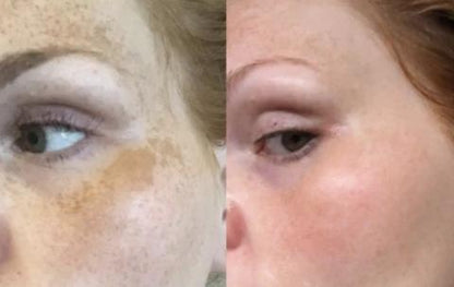 Mabox Vitamin C Serum; Mabox 2.5% Retinol Moisturizer Face Cream