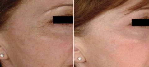 Mabox Vitamin C Serum; Mabox 2.5% Retinol Moisturizer Face Cream