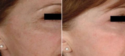 Mabox Vitamin C Serum; Mabox 2.5% Retinol Moisturizer Face Cream