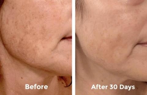 Mabox Vitamin C Serum; Mabox 2.5% Retinol Moisturizer Face Cream