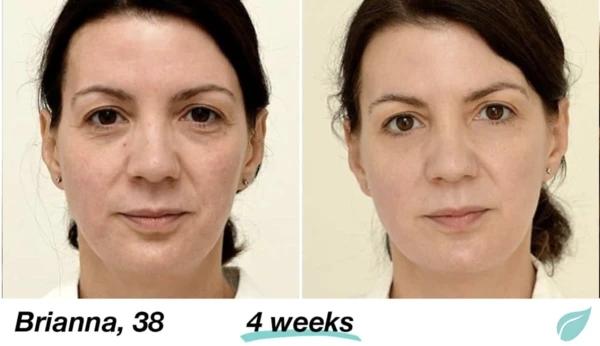 Mabox Vitamin C Serum; Mabox 2.5% Retinol Moisturizer Face Cream