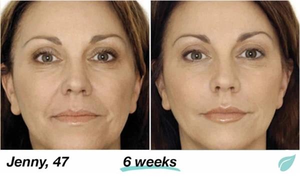 Mabox Vitamin C Serum; Mabox 2.5% Retinol Moisturizer Face Cream