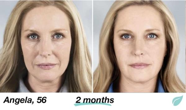 Mabox Vitamin C Serum; Mabox 2.5% Retinol Moisturizer Face Cream