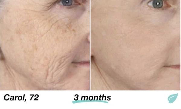 Mabox Vitamin C Serum; Mabox 2.5% Retinol Moisturizer Face Cream