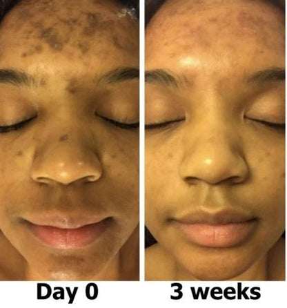 Mabox Vitamin C Serum; Mabox 2.5% Retinol Moisturizer Face Cream