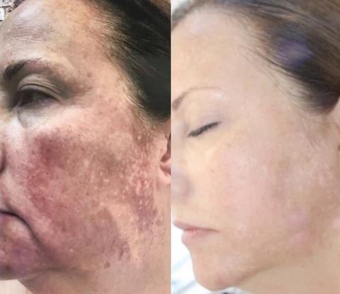 Mabox Vitamin C Serum; Mabox 2.5% Retinol Moisturizer Face Cream