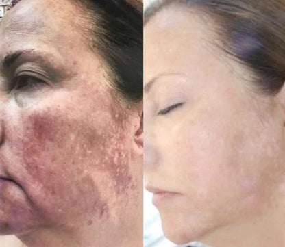 Mabox Vitamin C Serum; Mabox 2.5% Retinol Moisturizer Face Cream
