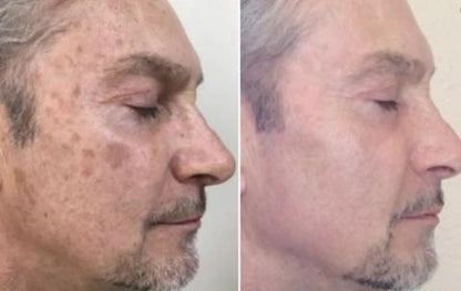 Mabox Vitamin C Serum; Mabox 2.5% Retinol Moisturizer Face Cream