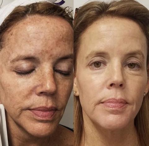 Mabox Vitamin C Serum; Mabox 2.5% Retinol Moisturizer Face Cream